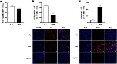 Effects of omega-3 polyunsaturated fatty acids on cellular development in human ovarian granulosa tumor cells (KGN)